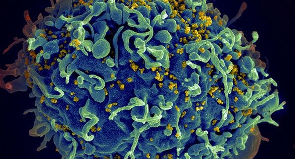 Battle against HIV/AIDS endangered by ‘perfect storm’