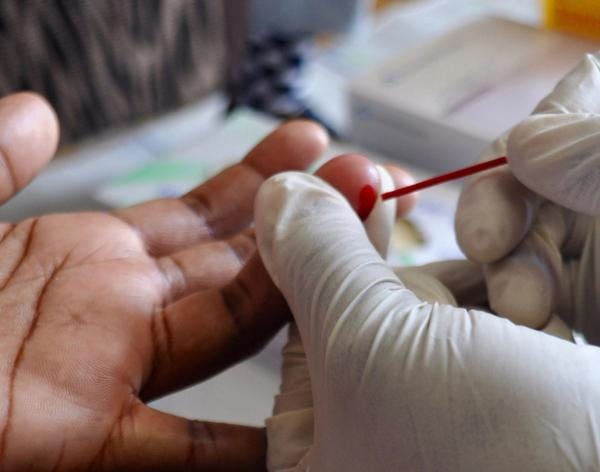 Prevalencia del VIH, hepatitis viral B/C y tuberculosis, y consecuencias de tratamiento entre personas que consumen drogas: Resultados de la implementación del primer centro de acogida en Mozambique